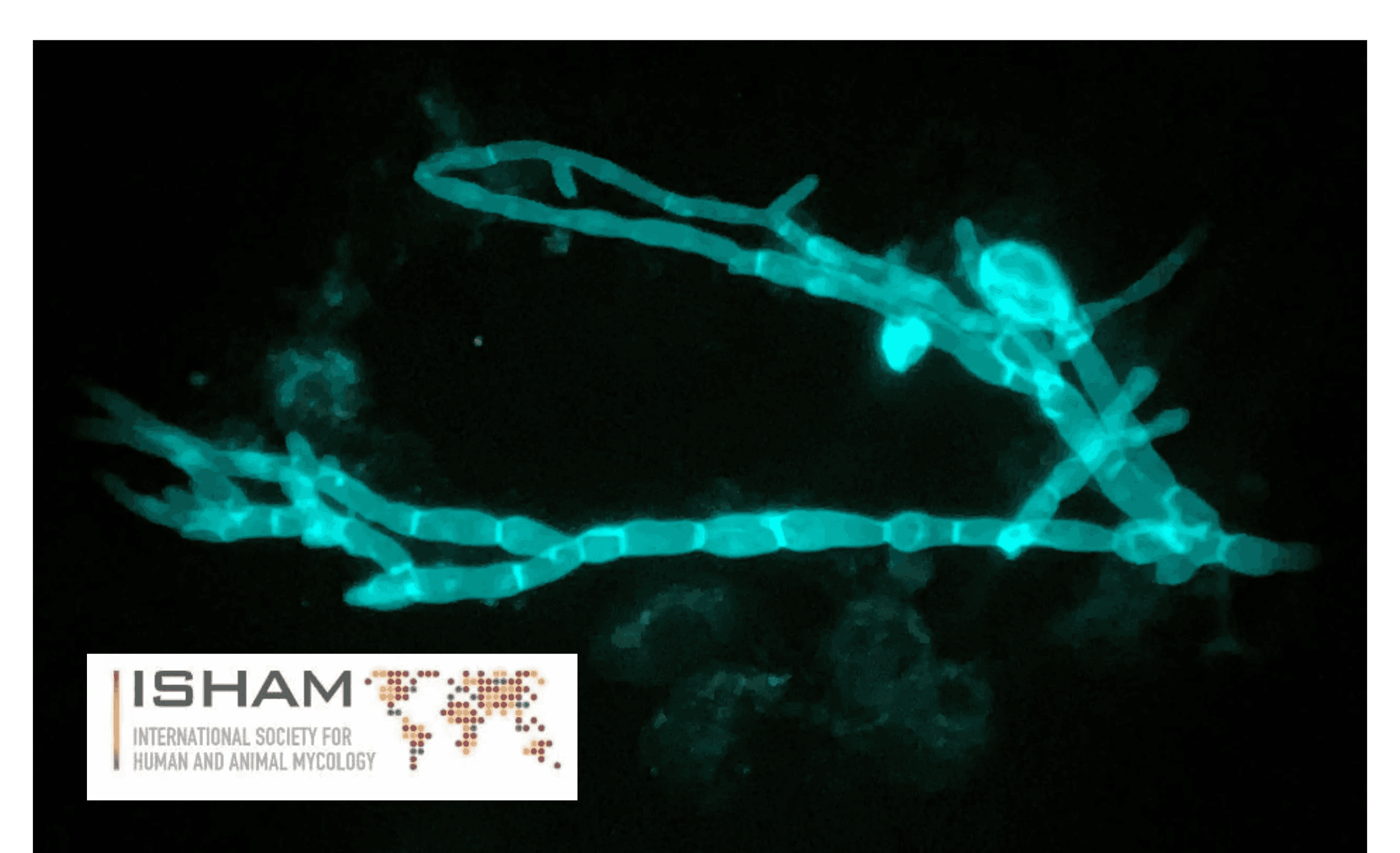 Fungal Dx Meeting And Conference