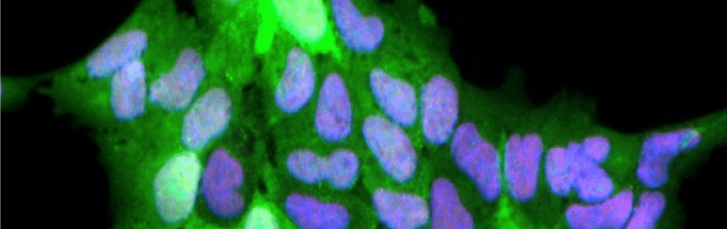 DMM Journal Meeting: Innovative Preclinical Models for Pediatric Cancer Research