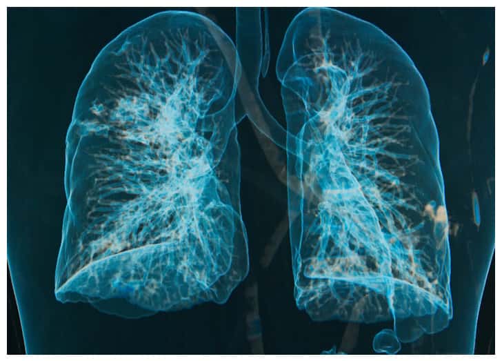 Pulmonary and Critical Care Medicine