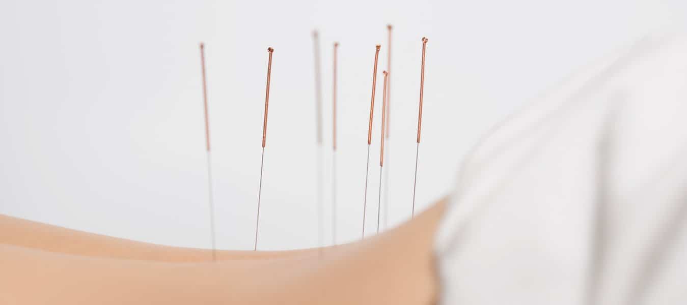 Cadaver Lab for the Acupuncturist
