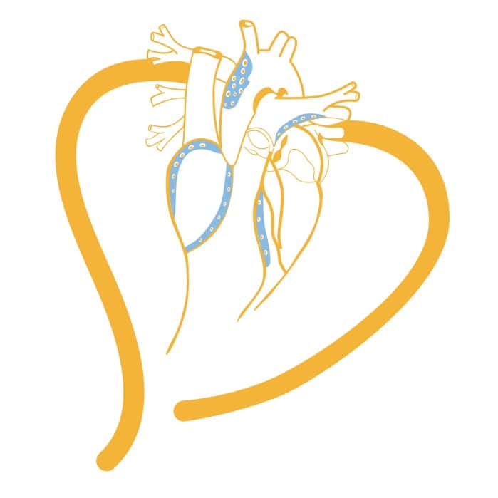 World Congress on Insulin Resistance Diabetes & Cardiovascular Disease